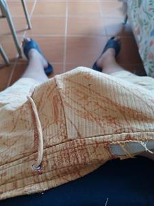 Kolbaszoskrumpli 30 éves férfi, Hajdú-Bihar megye