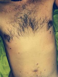 Peti 47 éves férfi, Fejér megye