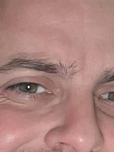 Robi 37 éves férfi, Budapest