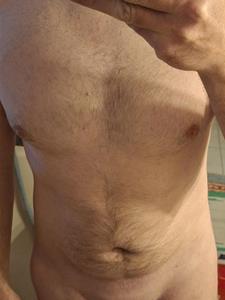 Robi 37 éves férfi, Budapest