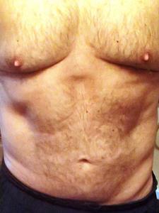 Spricc 59 éves férfi, Budapest