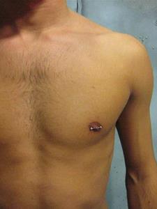 vixiking 40 éves férfi, Budapest